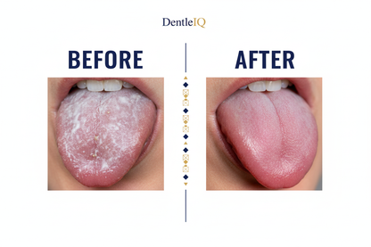 Tongue Scraper Before & After